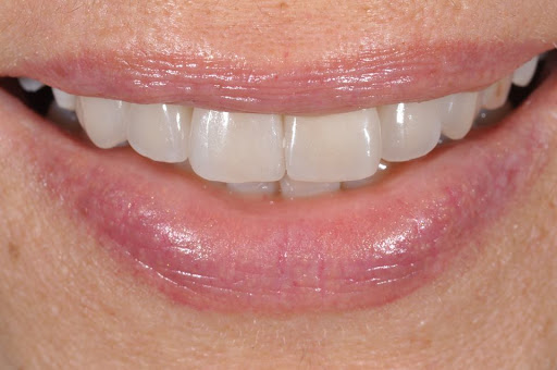 Ortodontista Venezia