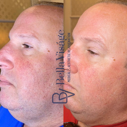 Explore abs tattoo ideas, creative tattoo ideas in Lakeland, available at Bella Visge Medical & Aesthetic Rejuvenation