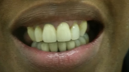 Smile Again Dental Lab