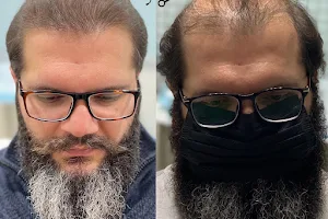 Dr Muhammad Salman Khan - Hair Transplant Expert in Islamabad image