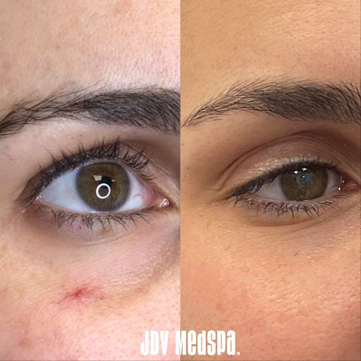 Explore tattoos ideas for chest, creative tattoo ideas in Canton, available at JDV Med Spa