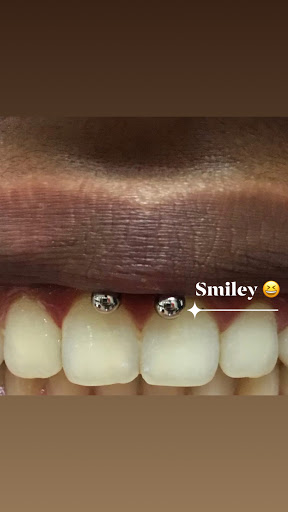 Explore coverup tattoo ideas, creative tattoo ideas in Dallas, available at Fly Ink, Inc.