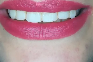 Dental Krysli image