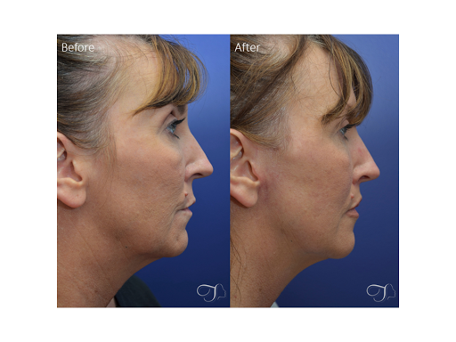 Kristina Tansavatdi, MD Tansavatdi Cosmetic & Reconstructive Surgery image