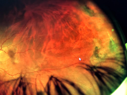 Optician «Advanced Vision of Louisville», reviews and photos, 4414 Shelbyville Rd # 204, Louisville, KY 40207, USA