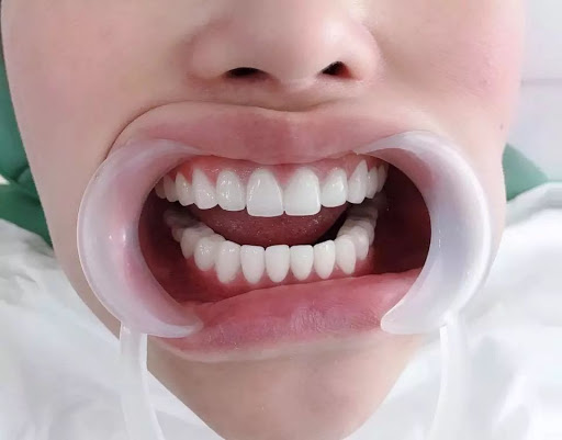 Af1qipmv2yiow Fg0n7vhgqoxbkdyp5dk3dnotnufuhg