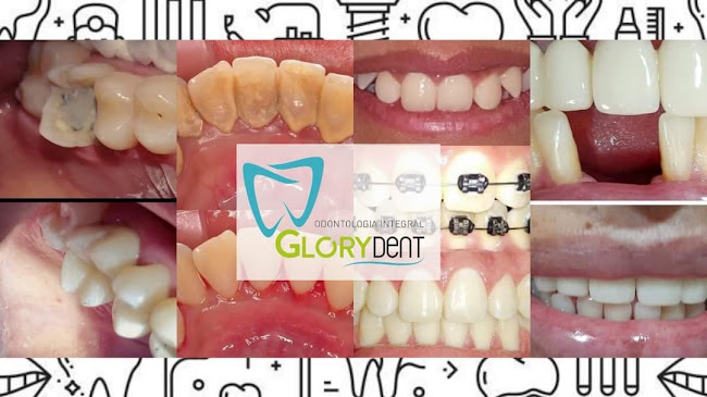 Glorydent Odontologia Integral
