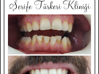 Diş Hekimi Şerife TÜRKERİ Kliniği