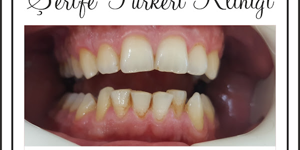 Diş Hekimi Şerife TÜRKERİ Kliniği