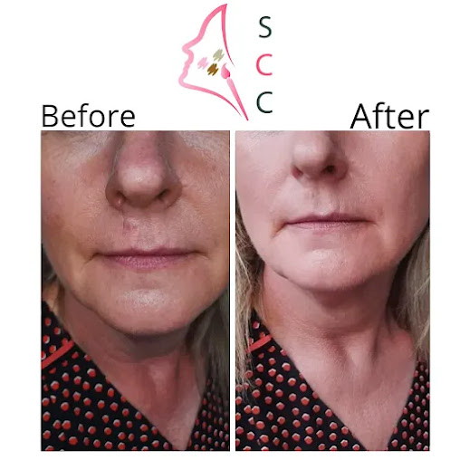 Skin Camouflage Care - Skin Camouflage Care