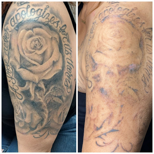 Explore hunting tattoo ideas for guys, creative tattoo ideas in Dearborn, available at Laser Duet Med Spa