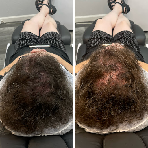 Explore vegan tattoos ideas, creative tattoo ideas in Roseville, available at NuHair Ink. Scalp MicroPigmentation & Aesthetic Clinic of Sacramento