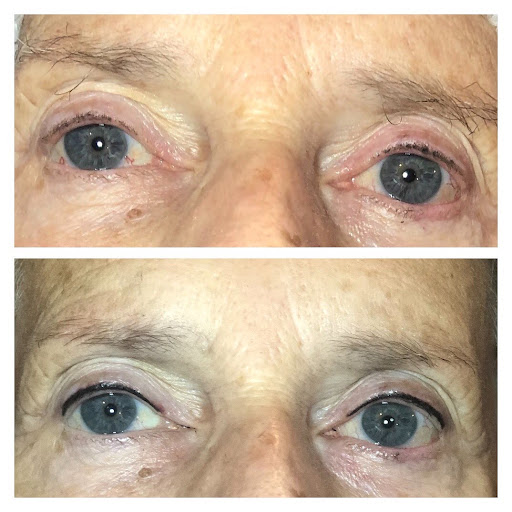 Photo of Facial Appeal