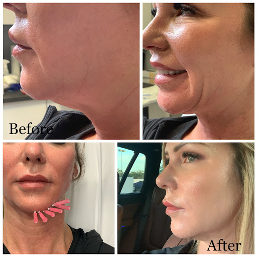 Explore firefighting tattoo ideas, creative tattoo ideas in Tampa, available at Luminous Skin and Laser