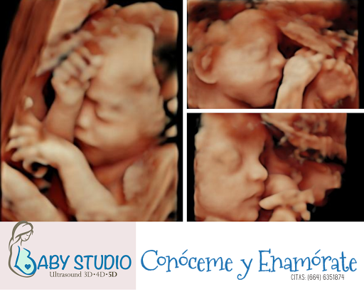 Baby Studio Ultrasonido 5D