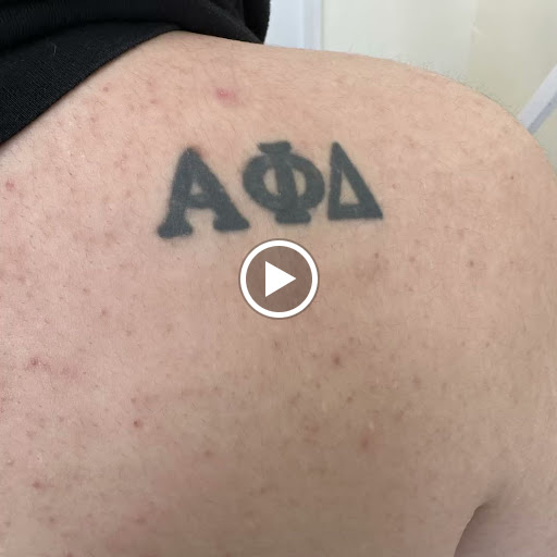 Explore dead tree tattoo ideas, creative tattoo ideas in Bayside, available at Laser Goddess