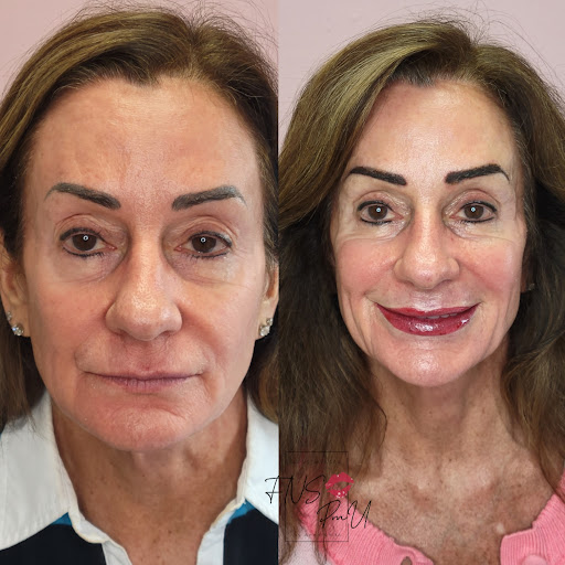 Explore kidney cancer tattoo ideas, creative tattoo ideas in Clearwater, available at FACE NAKED STUDIO, PERMANENT MAKEUP ACADEMY AND SPA