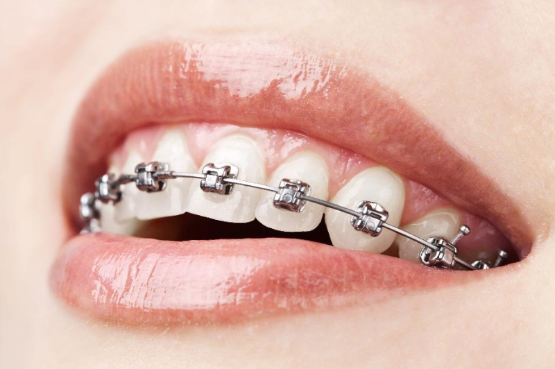 Oral I Consultorio Odontologico Integral