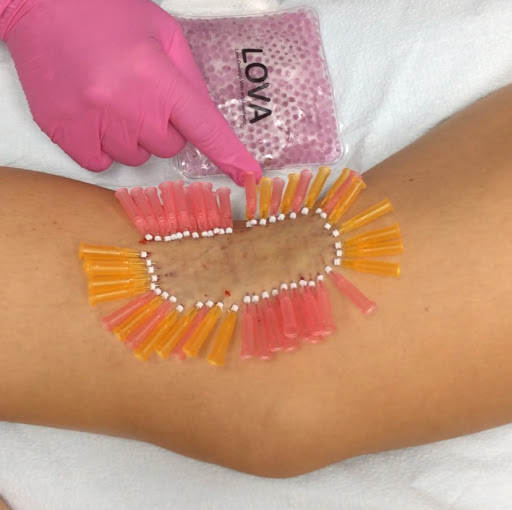 Explore dark souls tattoo ideas, creative tattoo ideas in Lake Oswego, available at Lake Oswego Vein and Aesthetic LOVA