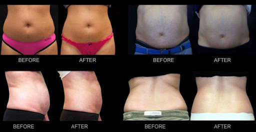 Medical Spa «True Med Spa», reviews and photos, 4260 N Drinkwater Blvd #110a, Scottsdale, AZ 85251, USA