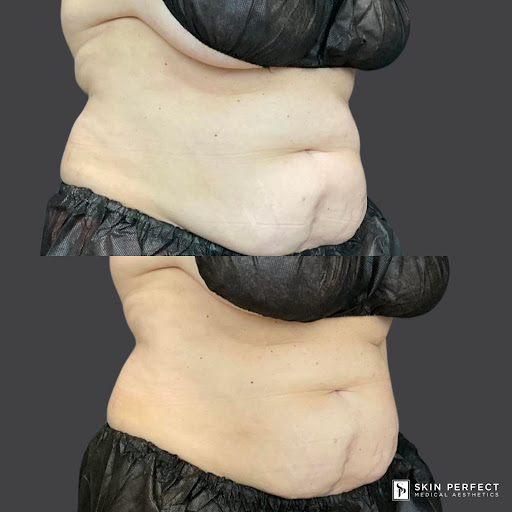 Explore mens tattoo sleeve idea, creative tattoo ideas in Whittier, available at Skin Perfect Medical Aesthetics