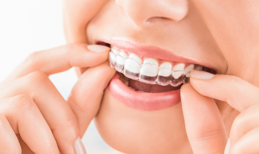 Wellington Village Orthodontics | Braces in Ottawa | Ottawa Orthodontist