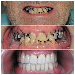 WK•R ODONTOLOGIA | Dentista Porto Alegre | Lente de Contato Dental / Implante Dentário / Zona Norte Porto Alegre