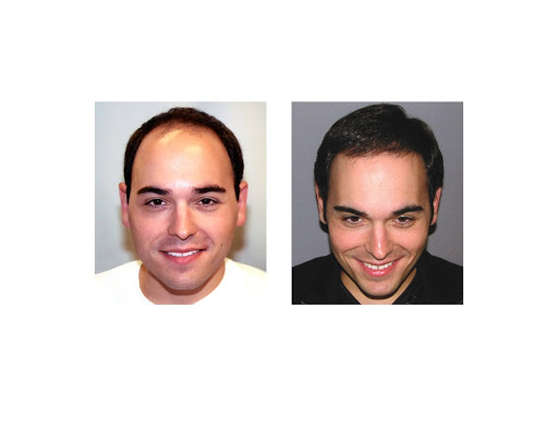 Hair Transplantation Clinic «Bosley Medical - Scottsdale», reviews and photos, 7025 N Scottsdale Rd #300, Scottsdale, AZ 85253, USA