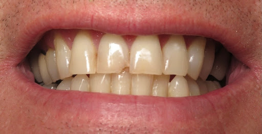 Bittner Family Dental Group image