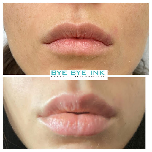 Find tattoo ideas for women small for your next unique tattoo in Middle Village at Bye Bye Ink Laser Tattoo Removal