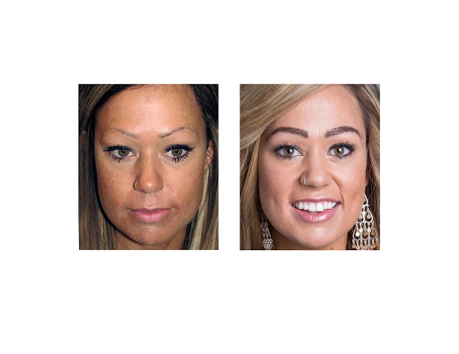 Hair Transplantation Clinic «Bosley Medical - Kansas City», reviews and photos, 460 Nichols Rd #350, Kansas City, MO 64112, USA