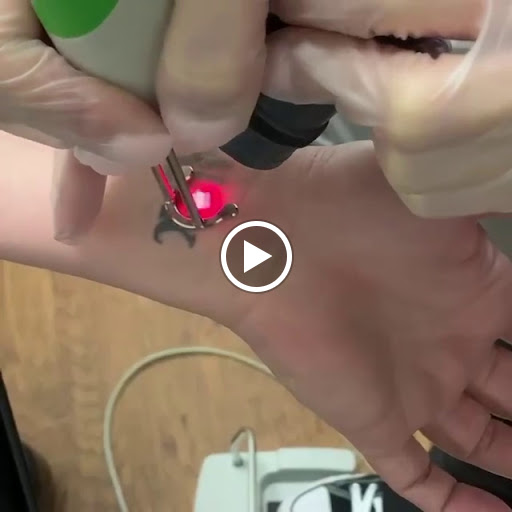 Explore japanese tattoo idea, creative tattoo ideas in Milwaukee, available at Removery Tattoo Removal & Fading