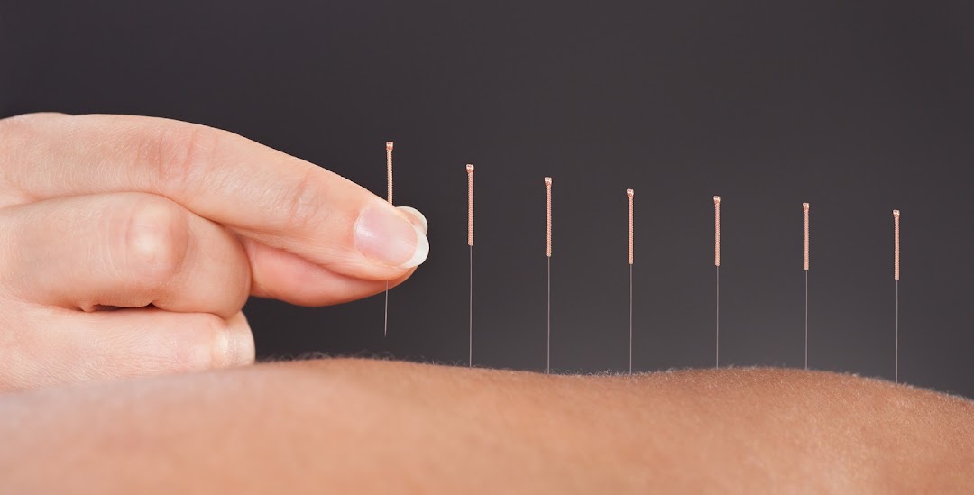 Access Acupuncture & Holistic Health
