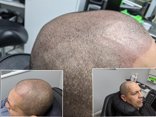 Explore book lovers tattoo ideas, creative tattoo ideas in Roseville, available at NuHair Ink. Scalp MicroPigmentation & Aesthetic Clinic of Sacramento