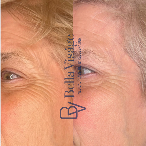 Explore navy seal tattoo ideas, creative tattoo ideas in Lakeland, available at Bella Visge Medical & Aesthetic Rejuvenation