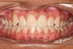 Braces N Faces Orthodontics image