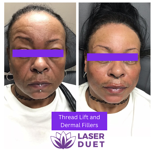 Explore bikini tattoo ideas, creative tattoo ideas in Dearborn, available at Laser Duet Med Spa