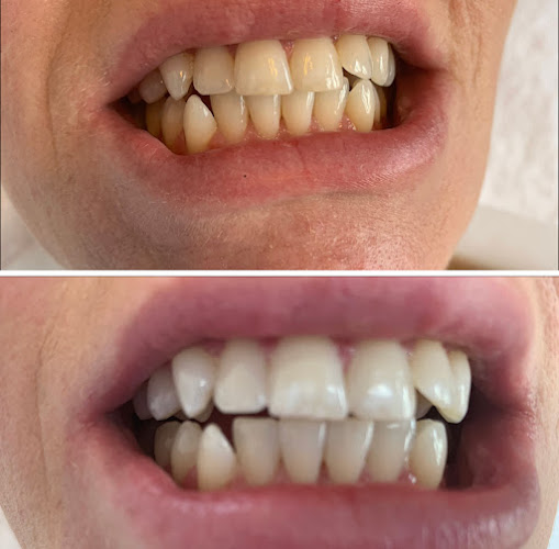 Reviews of The Teeth Whitening Lab - Christchurch Former Dental Therapist in Christchurch - Dentist