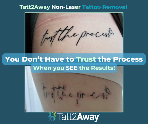 Explore nefertiti tattoo ideas, creative tattoo ideas in Huntington, available at Tatt2Away Huntington