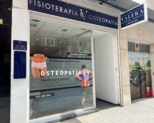 Clínica Valera | Fisioterapia y Osteopatía en Albacete en Albacete