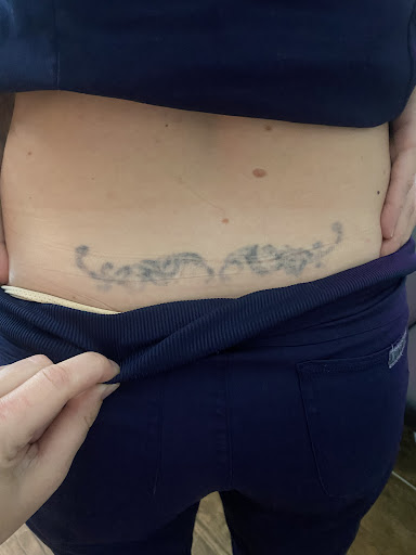 Find spinal cord tattoos ideas for your next unique tattoo in Lake Jackson at Second Chance Laser Tattoo Removal