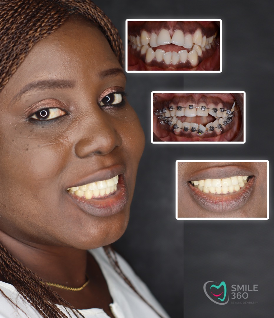 Smile 360 Dental Specialists