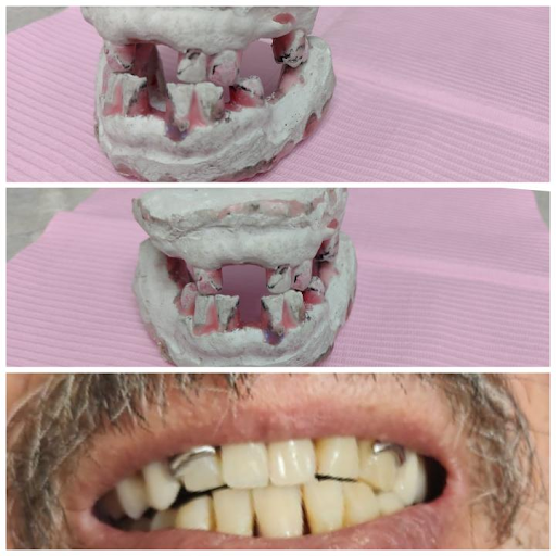 Dental Navarro Gdl
