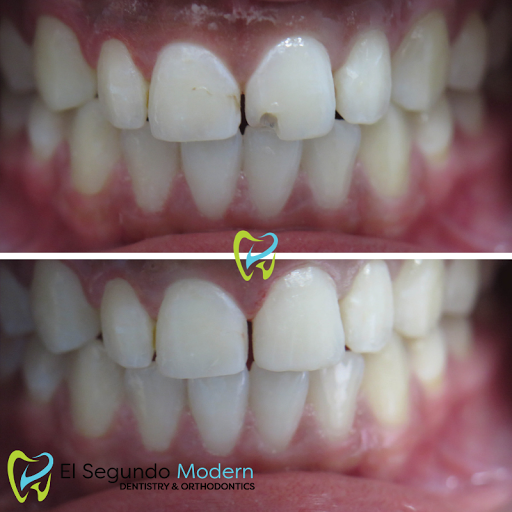 El Segundo Modern Dentistry image