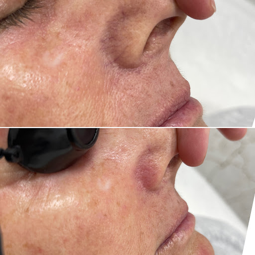 Explore yin yang tattoo ideas, creative tattoo ideas in Owensboro, available at The Skin Lab