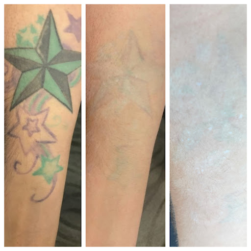 Explore atom tattoo ideas, creative tattoo ideas in Allen, available at Shipers Laser Tattoo Removal Center Dallas