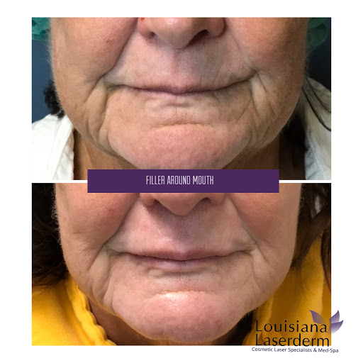 Explore army tattoo ideas for men, creative tattoo ideas in Baton Rouge, available at Louisiana Laserderm