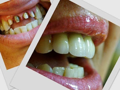 Beyaz Dent Diş Protez Laboratuvarı