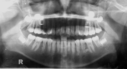 عيادة جودن لطب الأسنان - Goden Dental Clinic