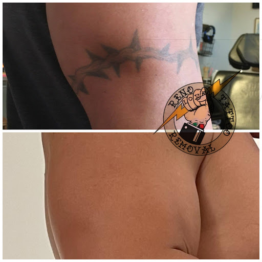 Explore freya tattoo ideas, creative tattoo ideas in Reno, available at Reno Tattoo Removal